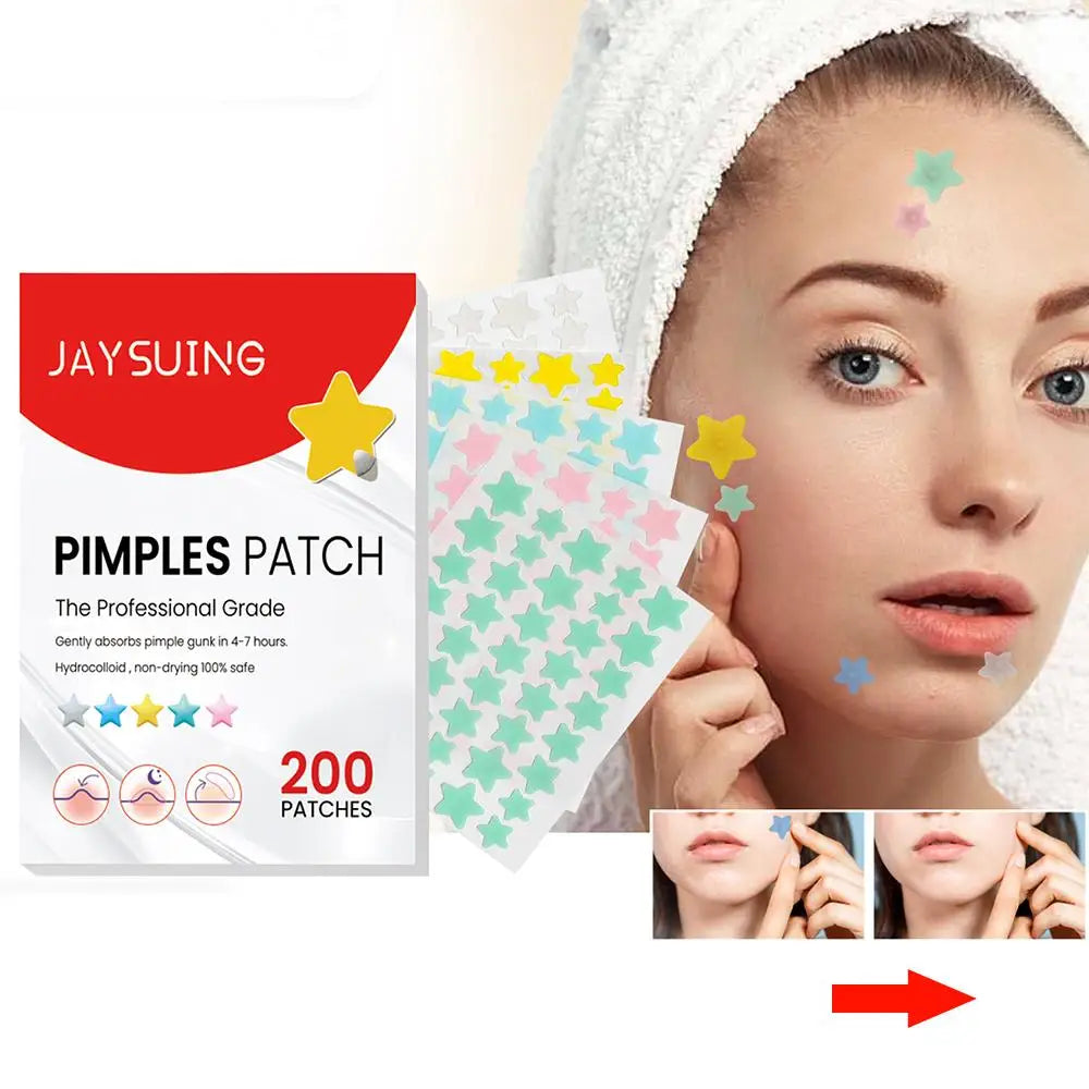 200 Patches Acnes Pimple Patches for Zits and Blemishes,Spots