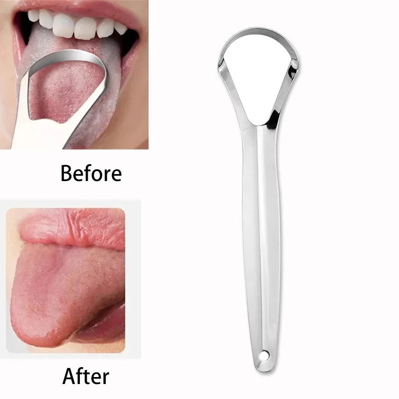 Hygiene Tongue Scraper Tongue Remover Halitosis Tongue Coating Oral