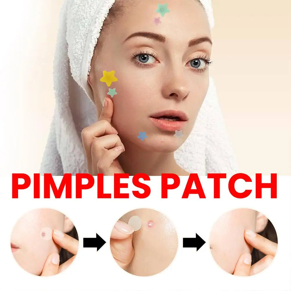 200 Patches Acnes Pimple Patches for Zits and Blemishes,Spots