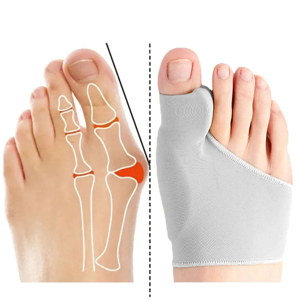 Toe Separator Hallux Valgus Bunion Corrector Orthotics Feet Bone Thumb